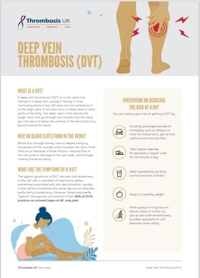 Deep Vein Thrombosis DVT